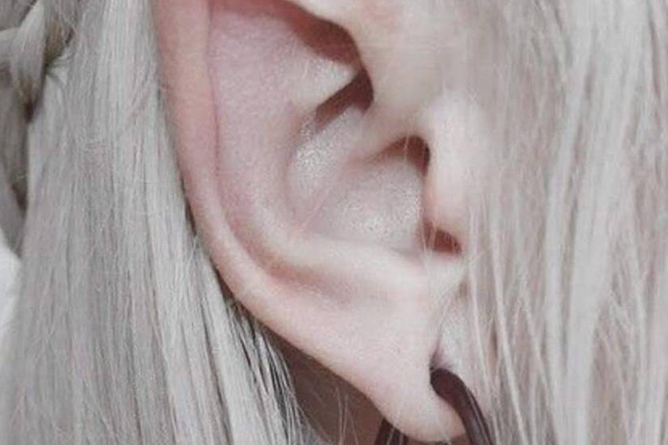 ‘Pointed ears,’ a new fashion in plastic surgery, on the rise - GulfToday