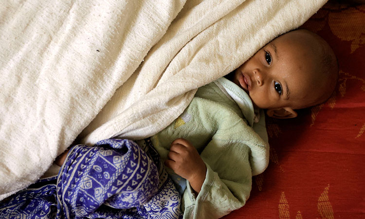 More people can't afford nutritious food and 148 million children are stunted by hunger, UN says