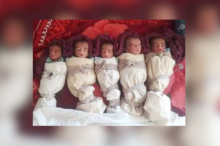 Pakistani woman gives birth to quintuplets