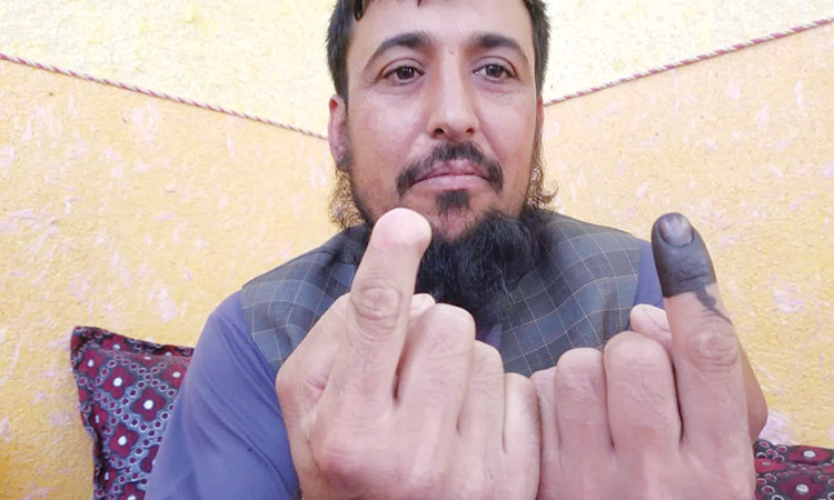 Taliban cut off his finger for voting, he defied them again