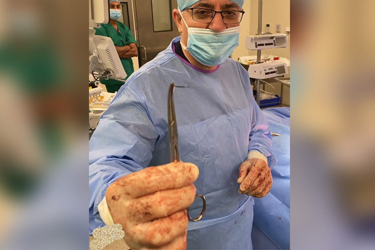 Broken needle left in body during surgery removed