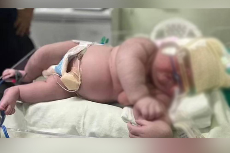 Brazilian mother gives birth to giant baby measuring 2ft tall and weighing 7.3kg