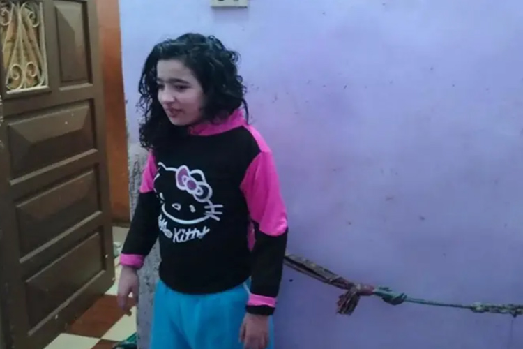 18-year-old Egyptian girl chained for 10 years by family because of rare disease