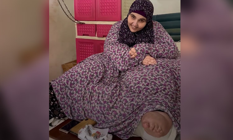 400kg Jordanian woman evacuated to hospital from her room after 16 years