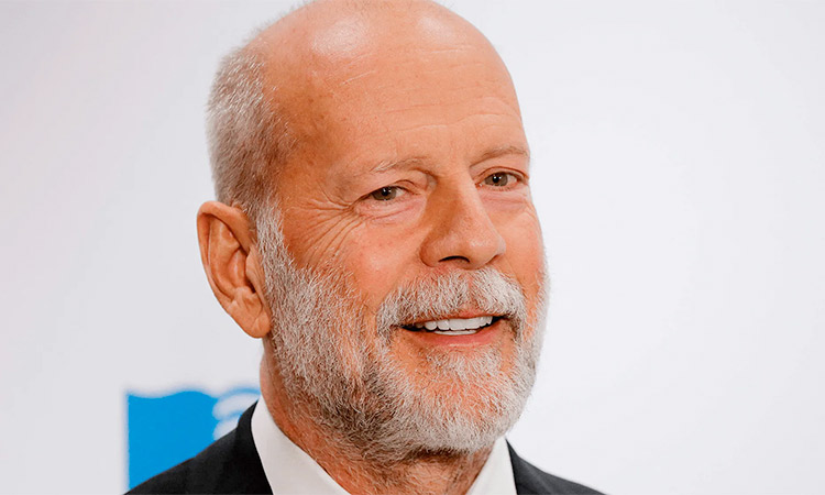 Bruce Willis, aphasia, language, and neurology