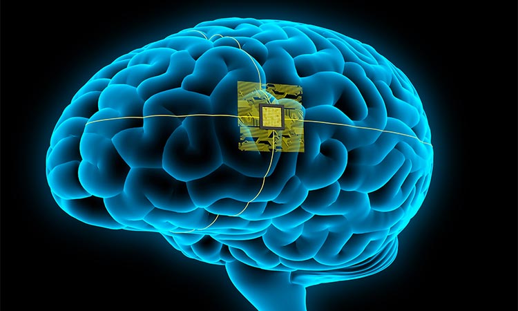 Would you let Elon Musk implant a device in your brain?