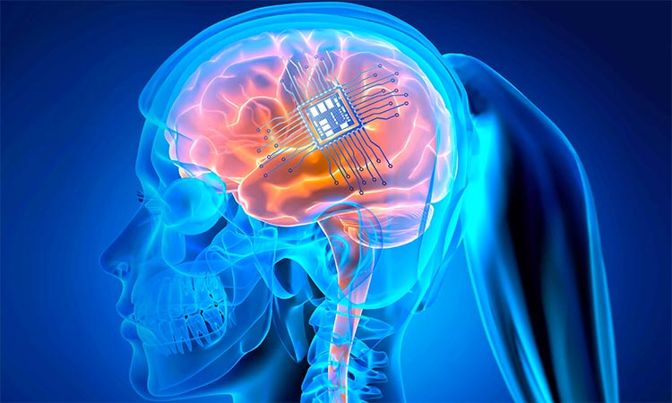 Brain implants raise hope for the speech impaired